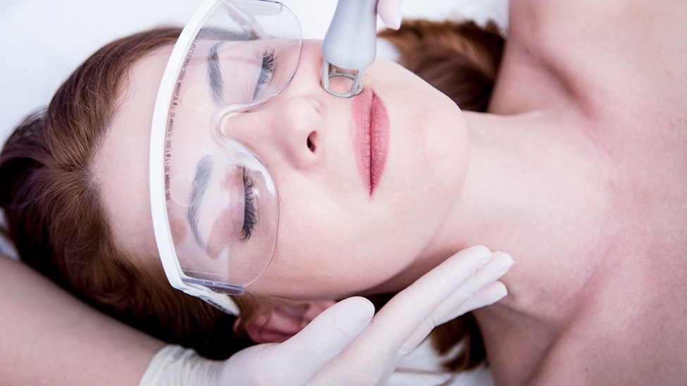 Understanding Facial Laser Treatments How Do They Work Healthy Life Lived