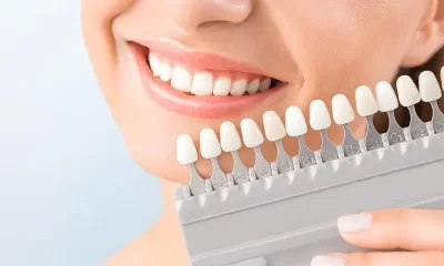 porcelain veneers