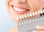 porcelain veneers