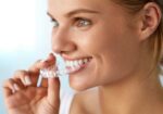 Clear Aligners