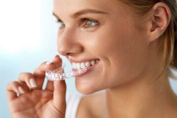 Clear Aligners