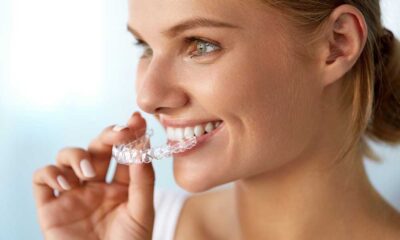 Clear Aligners