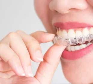 Modern Orthodontic Options