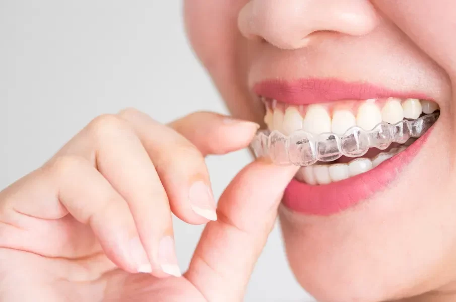 Modern Orthodontic Options