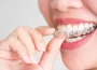 Modern Orthodontic Options