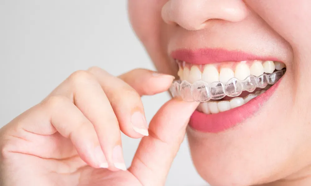 Modern Orthodontic Options